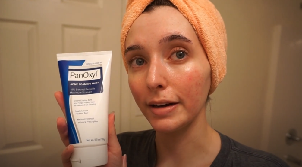 best face wash for acne prone skin